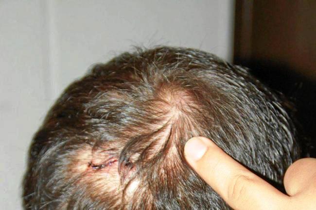 Comerciante de Paz de Ariporo fue golpeado en intento de robo