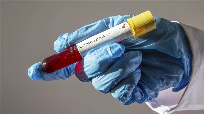 Instituto Nacional de Salud confirma un nuevo caso positivo de COVID-19 en Casanare